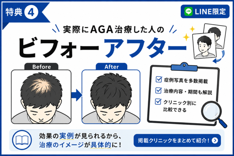 【特典④】実際にAGA治療した人のビフォーアフター